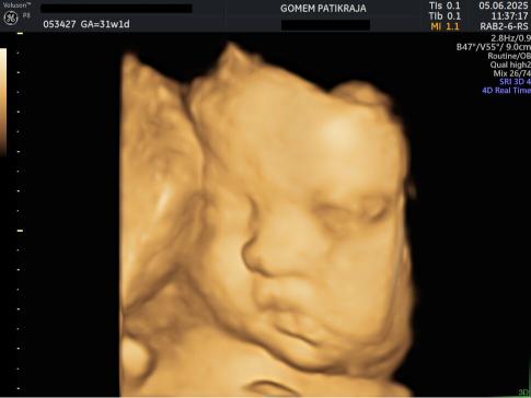 Dokumentasi USG Janin 39 Minggu Lengkap: Posisi & Aktivitas Bayi