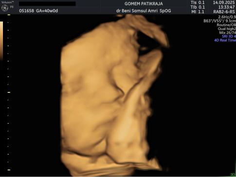 Penampakan Bayi di Rahim USG 40 Minggu: Berat, Panjang & Organ Penampakan Bayi di Rahim USG 40 Minggu: Berat, Panjang & Organ